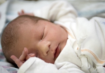 What to do if your baby has jaundice?