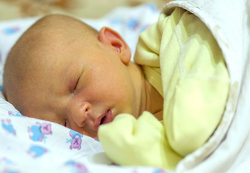 What to do if your baby has jaundice?